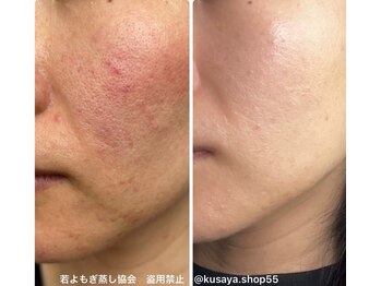 リレフー(Relafy)/★美肌★30代女性