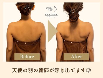 ラフリー 武蔵小杉院(RUFFREE)/ぽっこり肩改善へ【武蔵小杉】