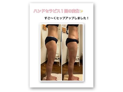 ビューティアップ 茶屋町店(Beauty Up)の写真