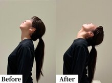 ソレア(Solea)/首肩こり・ストレートネック改善