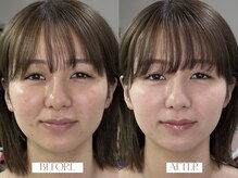 ユカ(YUKA)の雰囲気（パーソナルカラー診断＆ぴったり合うファンデで美肌メイク体験）
