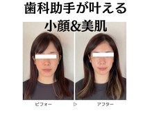 ふわりの雰囲気（オイルを使ったフェイシャルトリートメントです！）
