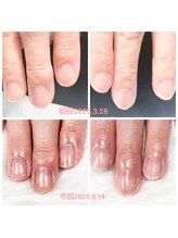 ココネ(cocone)/自爪育成