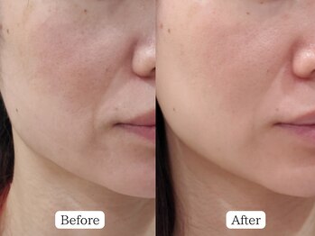 至空院/リアボーテスキンケア