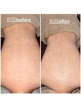 ミニョン(mignon)/まだ背中間に合いますよ？