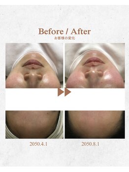 リリアージュ(Lilyage)/Waxで透明感とツヤ肌に♪