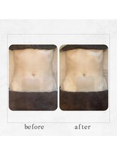 サロンドビューティー 美ふぅ(salon de beauty 美ふぅ)/ウエスト、お腹周り