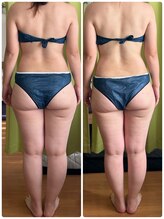 ヨサ パーク コアハート(YOSA PARK CORE HEART)/