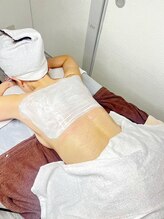 アンドナイン エス店(ANDNINE.) 背中ニキビ ハーブ