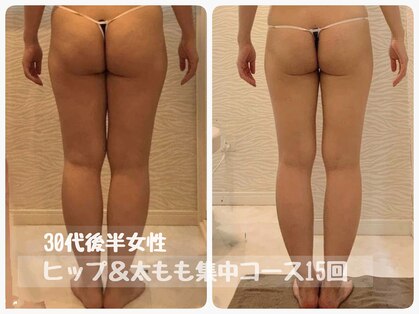 ピーエフ トウキョウ(PF TOKYO)の写真