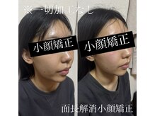 アマランス 立川店(Amalanth)の雰囲気（小顔矯正/面長解消/エラ張り/たるみ改善したい）