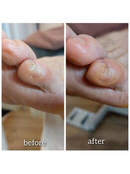 爪切り屋 足楽/