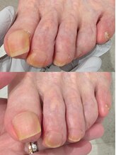 ハビッツ(habits)/ご家族の爪切り