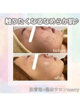 メリー 大和八木店(merry)/周りに褒められるなめらか艶肌へ