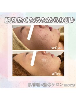 メリー 大和八木店(merry)/周りに褒められるなめらか艶肌へ