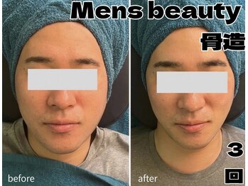 アンドワイ バイ サロンリーナ(&y by Salon Lena)/【メンズ毛穴洗浄×骨造】