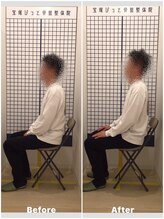 宝塚ぴっと骨盤整体院/慢性的な腰痛