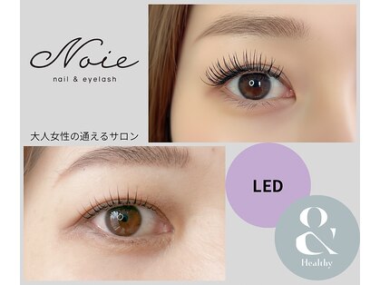 ノイエ(Noie)の写真