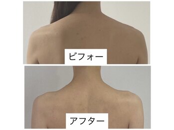 ヴィクトリアサロン(VICTORIA SALON)/全国からご来店いただく花嫁様★