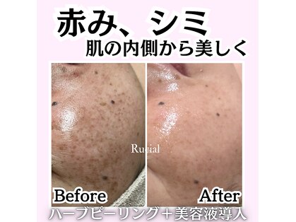 ルシアル(Rucial)の写真