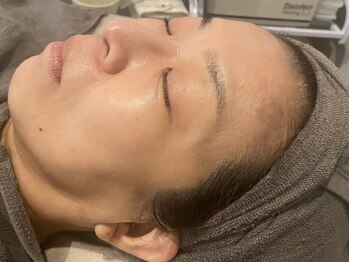 ラルミエール 緑店はなれ(la lumiere)/肌質改善!リゼネレート
