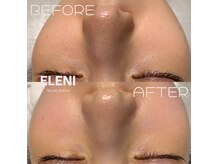 エレーニ 麻布十番(ELENI)の雰囲気（毛穴洗浄/麻布十番/小顔/コルギ/頭蓋骨/小顔矯正/フェイシャル）
