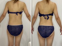 カプリス(CAPRiCE)/リンパドレナージュ