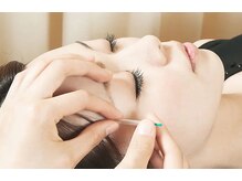 くつろぎ鍼灸整体院/☆美容鍼☆