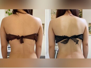 プライベートエステティックサロン クール(Coeur)/【脂肪燃焼/上半身デトックス】