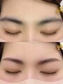 ホワイトアイ 岐阜(WHITE EYE) 左右非対称のお客様ご相談のります