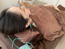 ハリファ鍼灸院 横浜関内院(HariFa鍼灸院)/美容施術/美容鍼