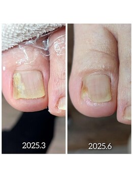 爪切り屋 足楽/