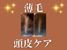 ルアナ(Luana.)の雰囲気（解決出来ない、薄い分け目・M字・育毛・頭皮のお悩み）