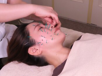 三軒茶屋鍼灸治療院/美容鍼