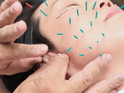 しまうら鍼灸院の写真