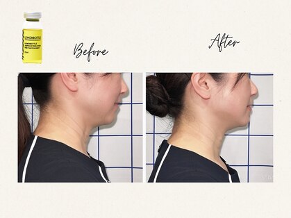 鍼灸院 満月の写真