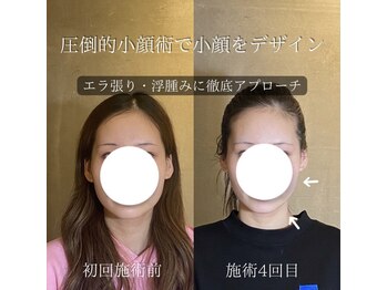 コア 中目黒店(Koa)/お客様ビフォーアフター!!