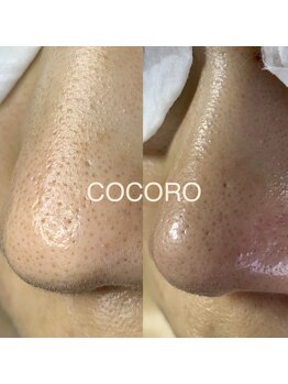 エイジングレスサロン ココロ 八女店(COCORO)/