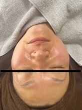 ナナラ(NANALA)/短時間で激変！！