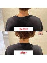 ナオル整体 福岡香椎院(NAORU整体)/40代女性施術事例【腕の痺れ】