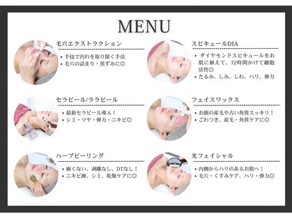 クロス(Xcross)の写真