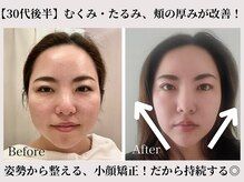 ユルフワ サロン(yurufuwa salon)の雰囲気（顔だけじゃないから変化する！そして持続する◎）