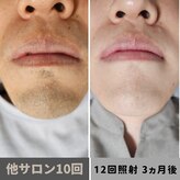 キムラケ 和光別邸(木村家 KIMURAKE)