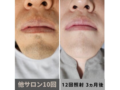 キムラケ 和光別邸(木村家 KIMURAKE)の写真