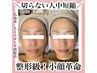 小顔ケアならコレ!予約殺到の最新技術8,800→5,800