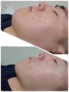 美ネージュ/憧れの小顔に