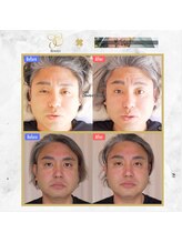 ルーツ(R∞ts)/Fan channelの衝撃的な結果