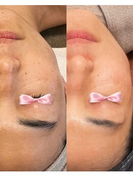 美温(mion)/10ヶ月の変化