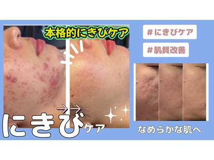 ミライ(Mirai)の写真