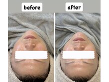 エルカ(eluca)の雰囲気（撮影日同日。肌管理やリフトアップ施術で一気にスッキリ小顔に）